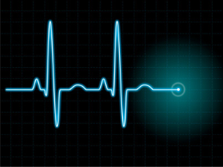 ekg curve